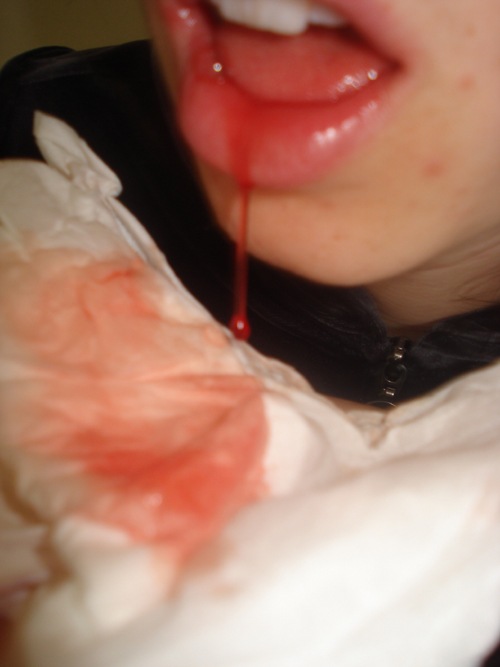 [blood]
