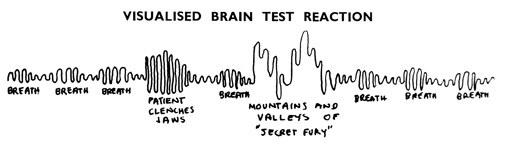 [Brain+scan.jpg]