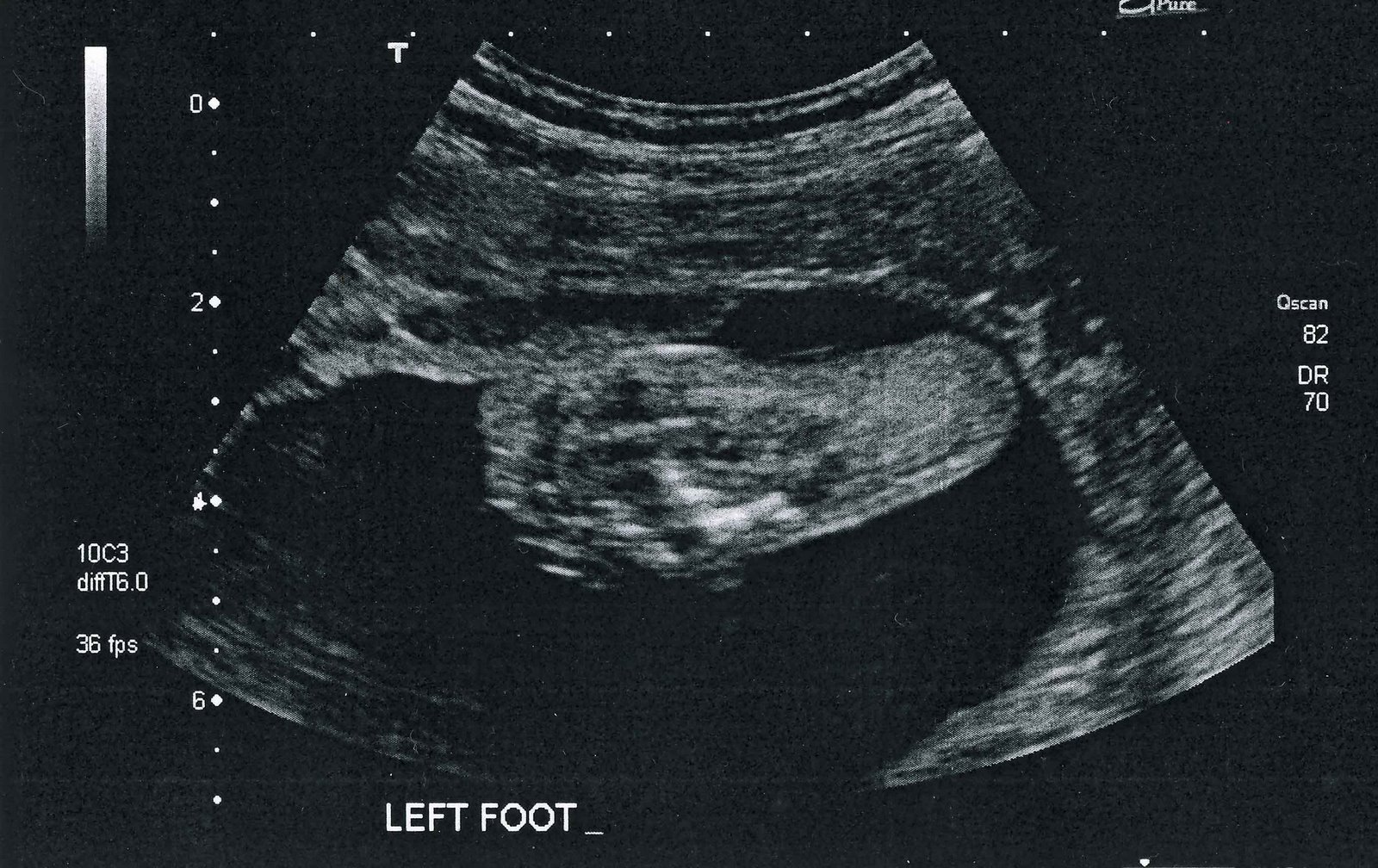 [27_week_ultrasound_foot.jpg]