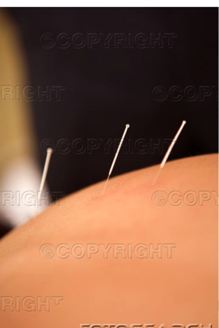 [623.acupunctureshot.jpg]