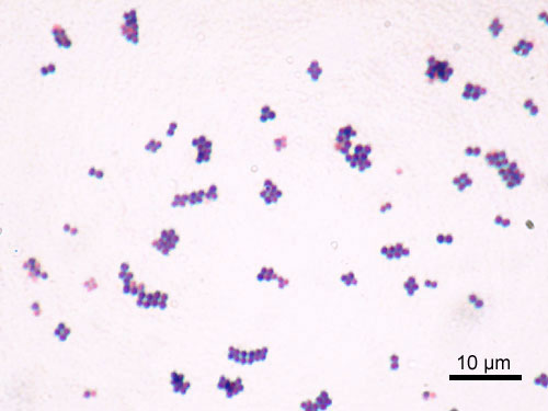 [Staphylococcus_aureus_Gram.jpg]