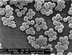 [240px-Staphylococcus_aureus_01.jpg]