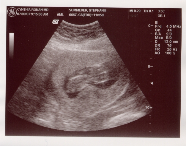 [ultrasound7-9-07.jpg]