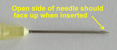 [needle_opening.jpg]