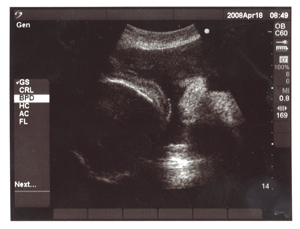 [2008+baby+ultrasound.jpg]