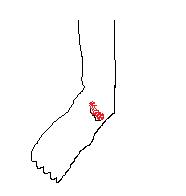 [My+Foot.jpg]