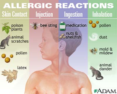 [allergic+reaction.jpg]