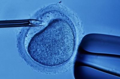 [in-vitro-fertilization-2.jpg]