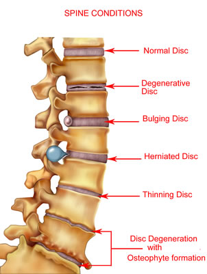 [diagram_spine_conditions.jpg]