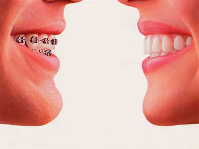 [ortodoncia.png]