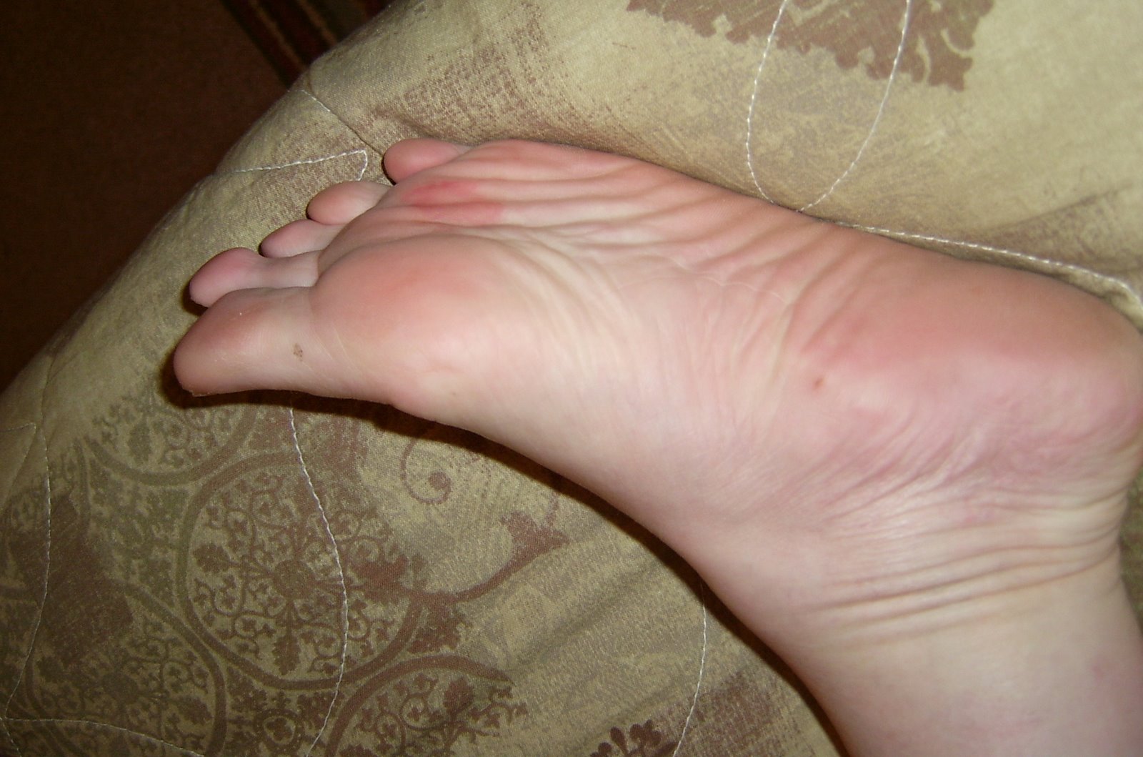 [2008-06-09+10+my+foot+looks+good+now.JPG]