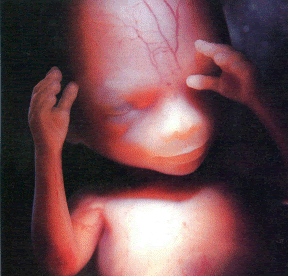 [16_Week_Fetus.gif]