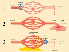 Reacción vascular (3 fases)