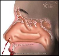 [Hidung-Anatomi.jpg]