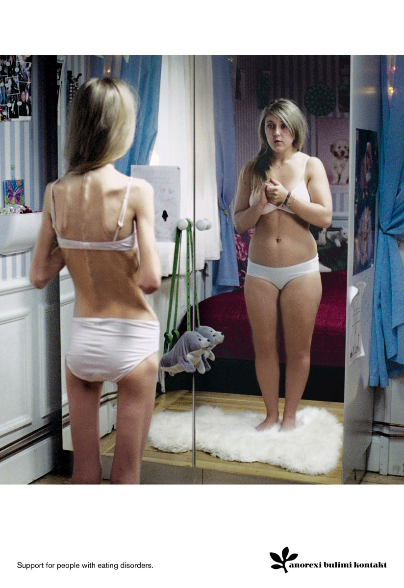 [anorexia.jpg]