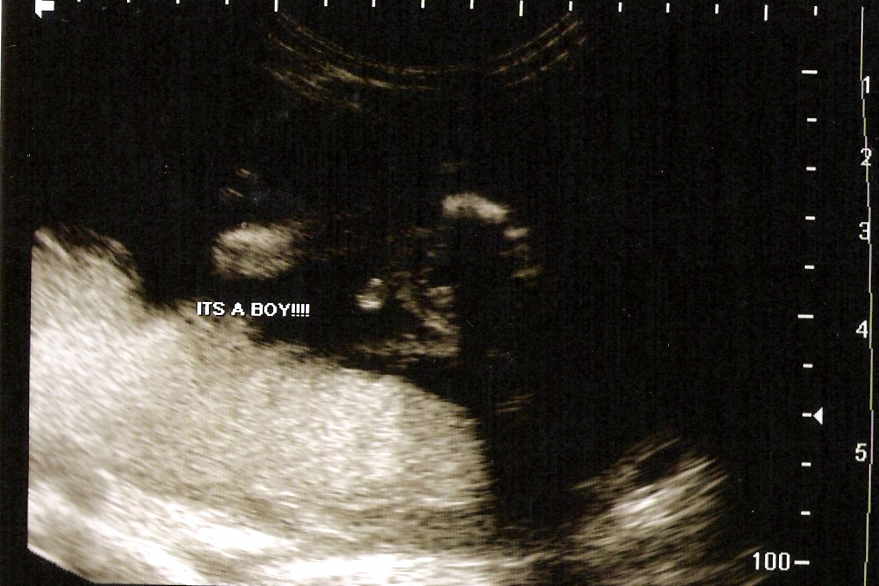 [Baby+boy+ultrasound-+It's+a+boy!.jpg]