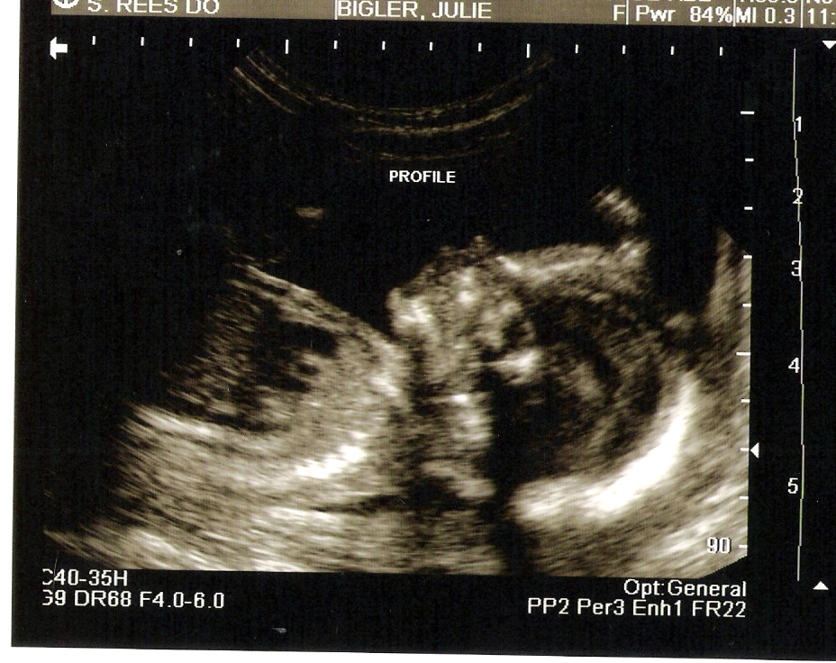 [Baby+boy+ultrasound+001.jpg]