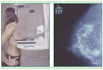 [mamografia.jpg]