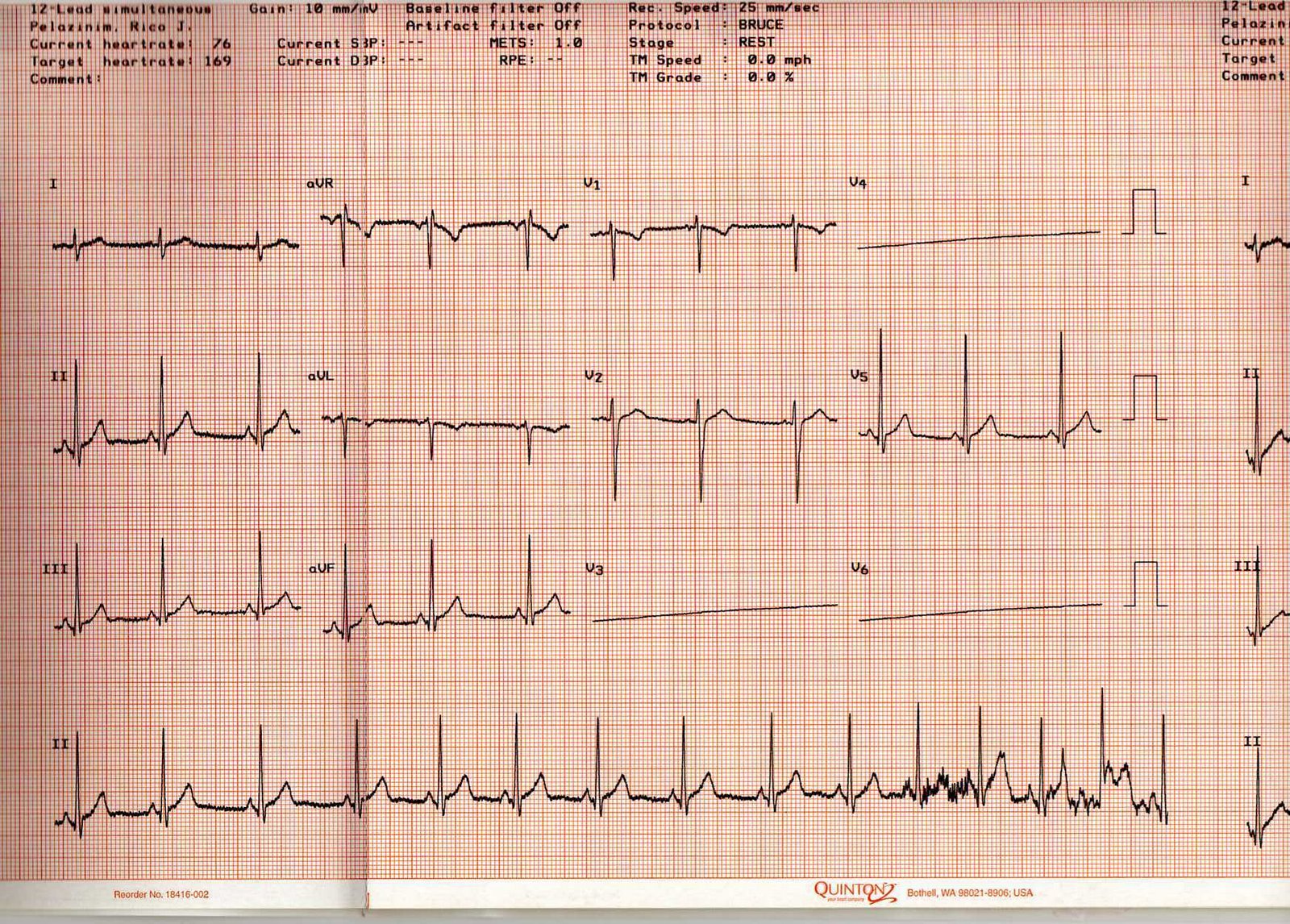 [EKG+1.jpg]