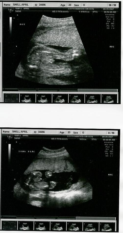 [ultrasound2b.jpg]