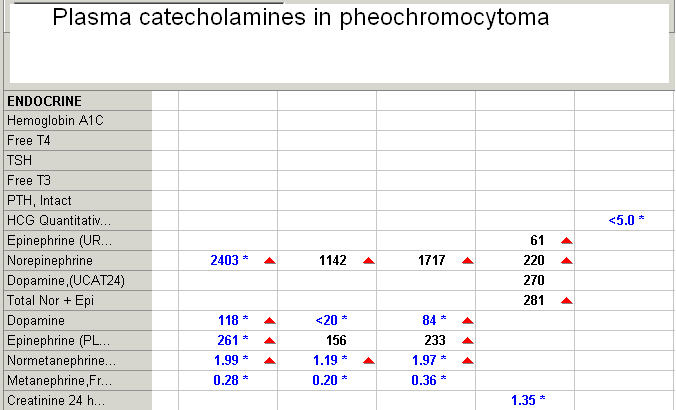 [Plasma+catecholamines+in+pheochromocytoma+1-1.png]
