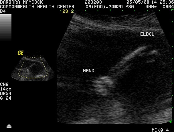 [Ultrasound+of+our+son+006.jpg]