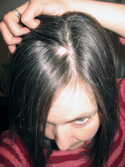 [2007.01.22+hair+hole.jpg]