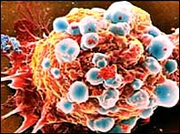 [20070731081353breast_cancer_cell_sp.jpg]