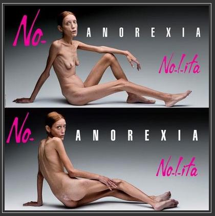 [anorexia2.jpg]
