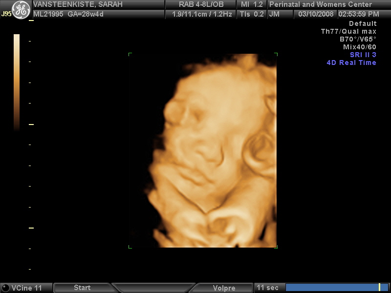 [Baby+Girl+Ultrasound+3+065.jpg]