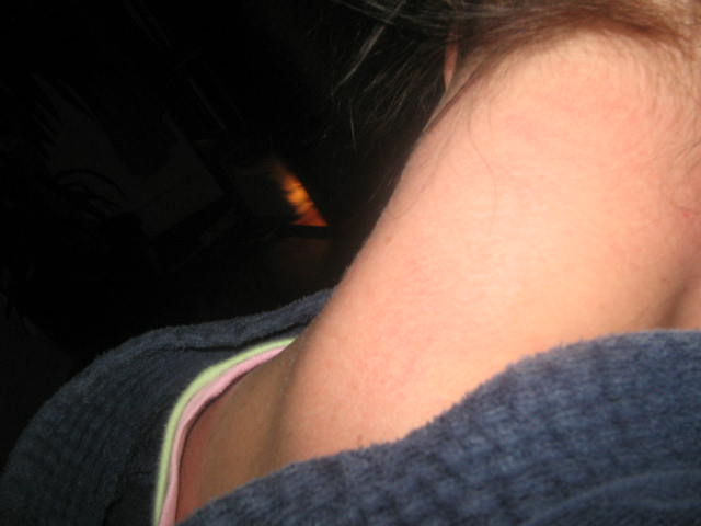 [2007_11_25_RA_neck+swollen+bad10.JPG]