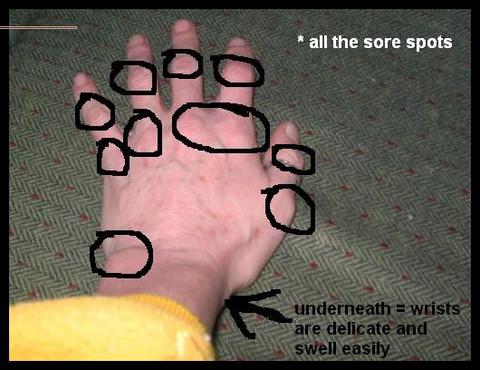 [all+the+sore+spots.jpg]