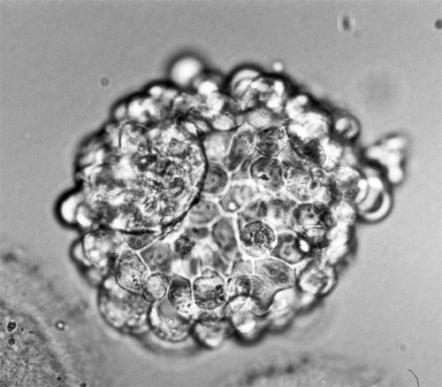 [Human-blastocyst.jpg]