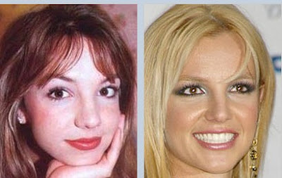 Good Plastic Surgery on Celebrity Plastic Surgery  Britney Spears Nose Job  Good Rhinoplasty