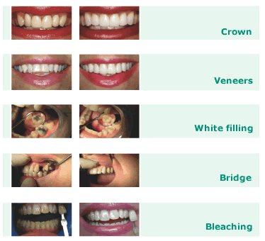 [cosmetic_dentistry+photos.bmp]