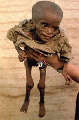 [fotos-desnutricion-en-africa.jpg]