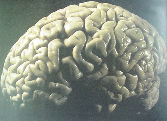 [brain2.jpg]