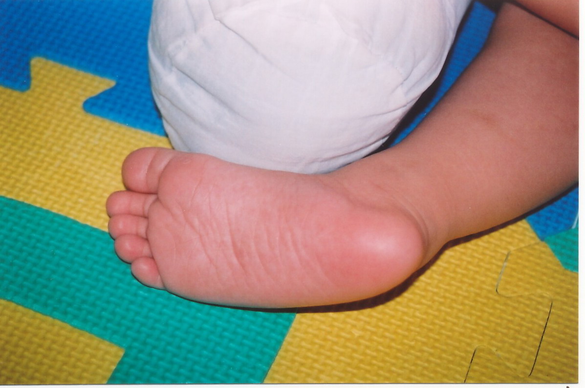 [Isaac's+Feet.jpg]