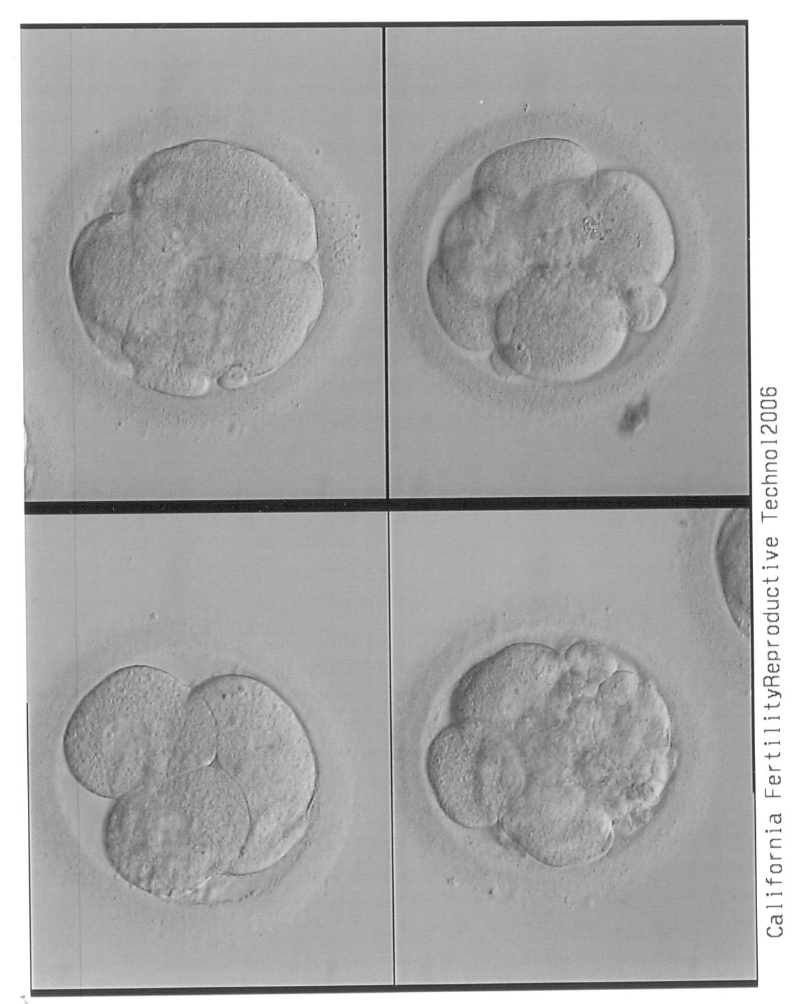 [Embryos+March+24,+2007.jpg]