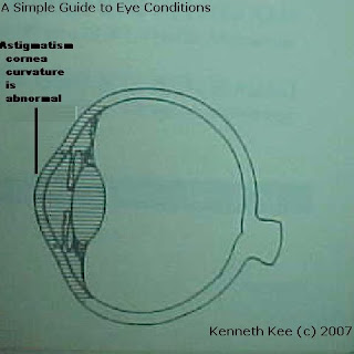 Simple Guide to Medical Conditions: October 2007