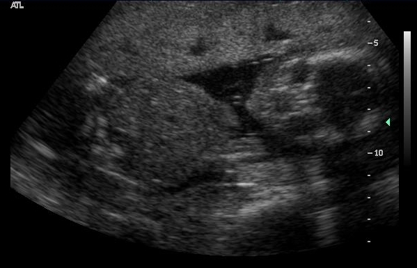 [ultrasound+1.jpg]