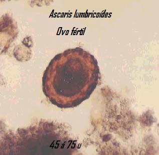 [Cópia+de+ascarislumbricoides1.jpg]