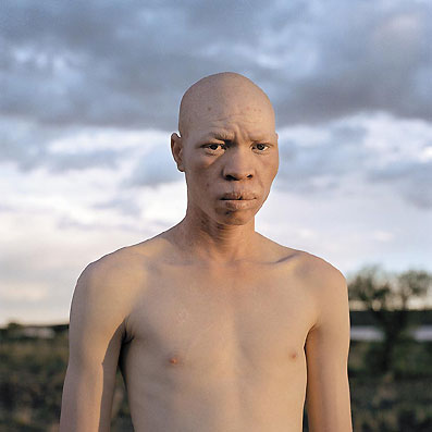 [portraits+of+people+whit+albinism.jpg]