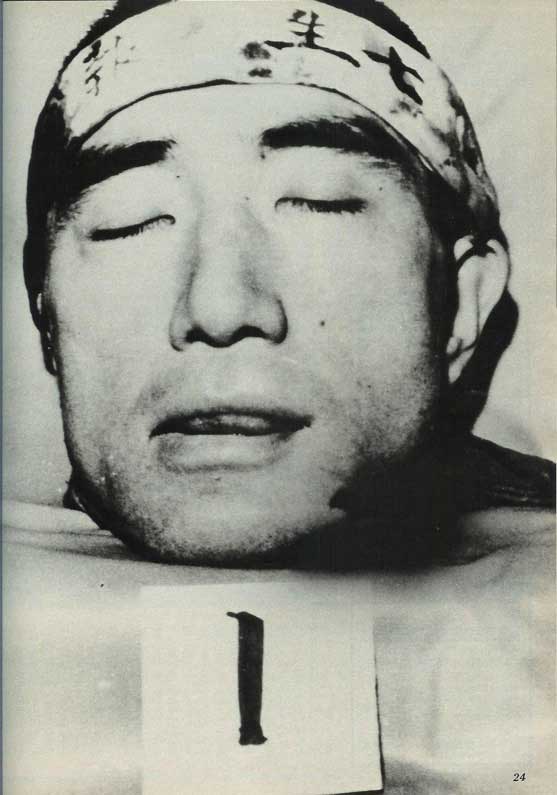 [Mishima's+severed+head.jpg]