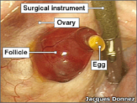 Ovulation takes place in the tissues of the ovary