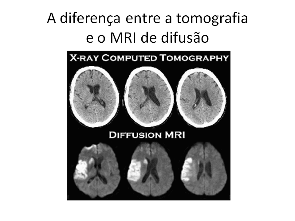 [MRI+de+difusão.png]