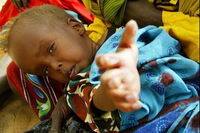 [chad_sudan_refugees_malnourished.jpg]