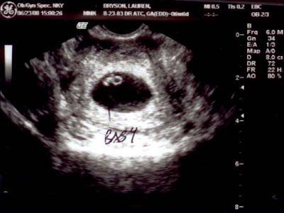 We were able to have a sonogram done at 5 weeks.