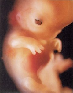 [week11-fetus.jpg]