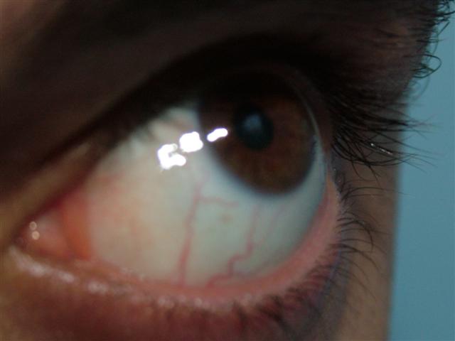 [Olhos+(6)+(Small).JPG]